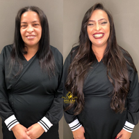 Antes e Depois
